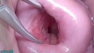 Japanese Wife Open Cervix Wide to watch inside Uterus - porn video